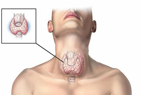 7. Thực phẩm bổ sung cho người bị tuyến giáp