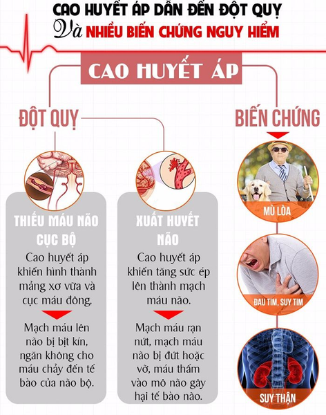 Symptoms of High Blood Pressure