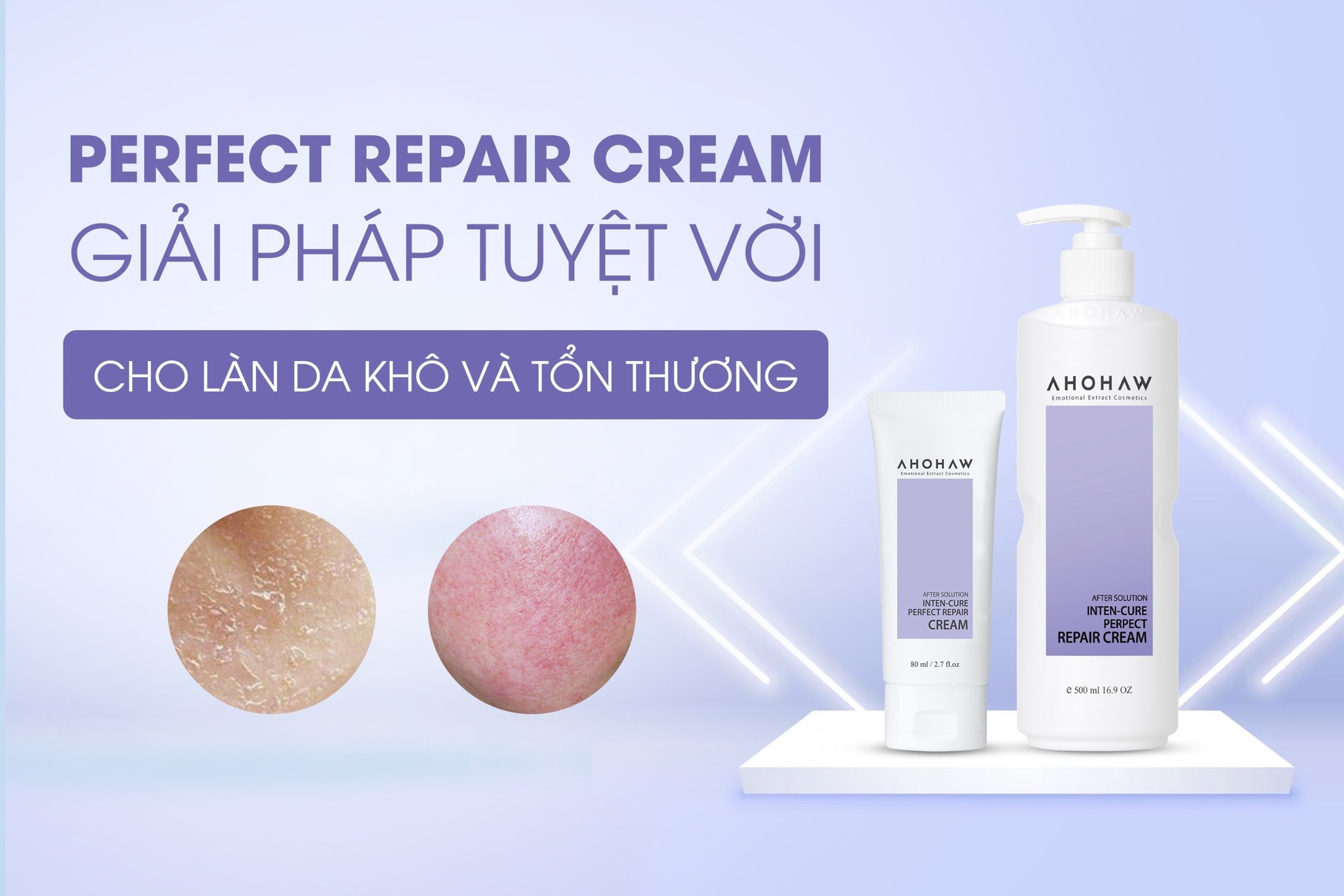 Kem B5: Giải pháp tuyệt vời cho làn da khô ráp, nhạy cảm và tổn thương –  AHOHWA VIỆT NAM