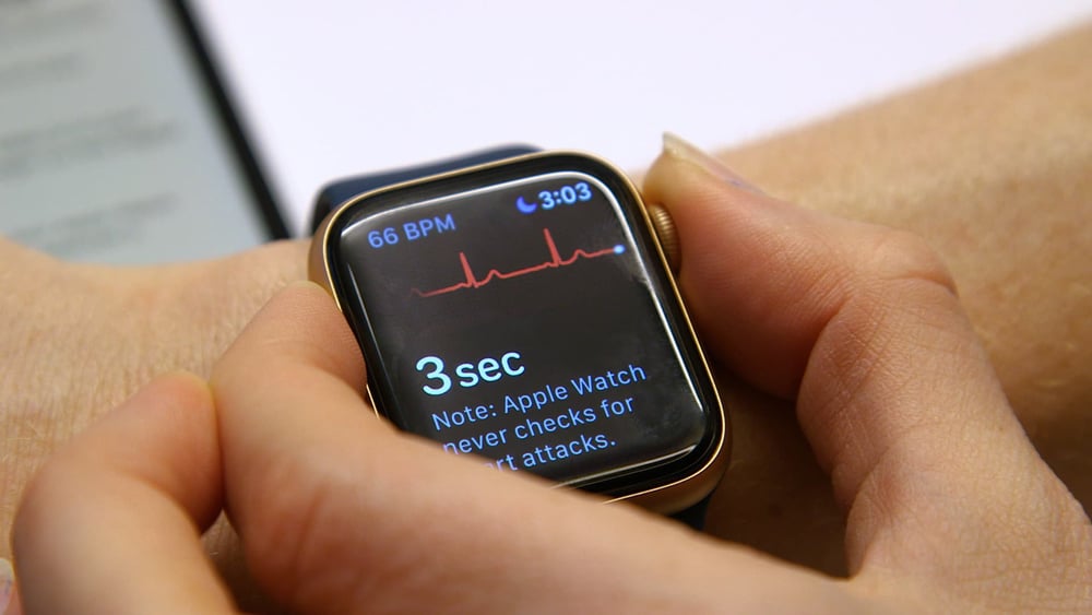 Cách đo điện tâm đồ ECG trên Apple Watch tại Việt Nam