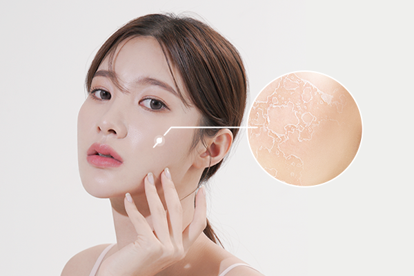 Cách chăm sóc da mặt sần sùi hữu hiệu nhất – NgoThanhPhu.Com