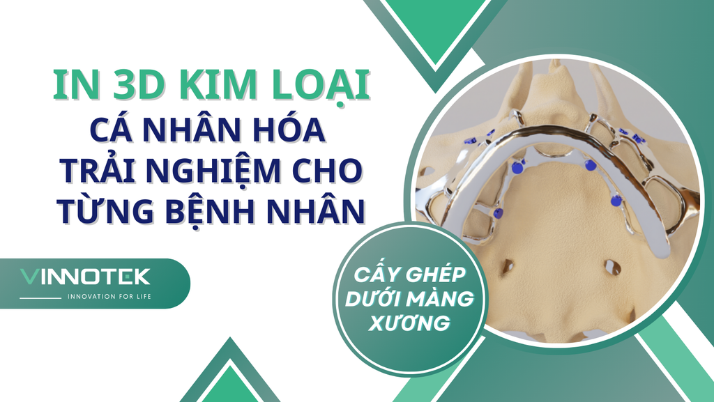 CẤY GHÉP NHA KHOA IN 3D: CÁ NHÂN HÓA TRẢI NGHIỆM CHO TỪNG BỆNH NHÂN
