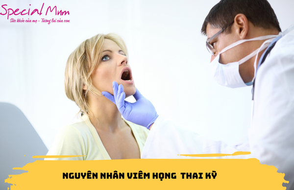 nguyên nhân viêm họng trong thai kỳ | Special Mum