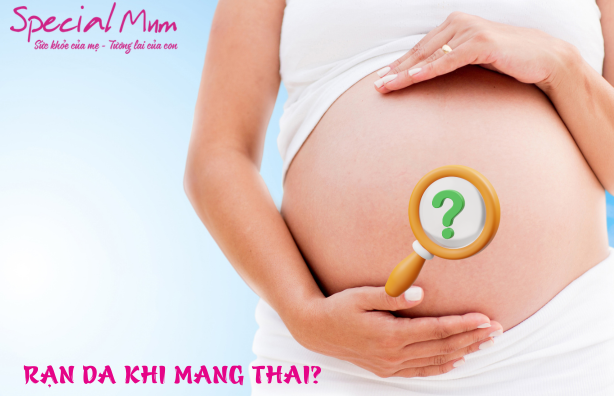 Tại sao rạn da khi mang thai? | Special Mum