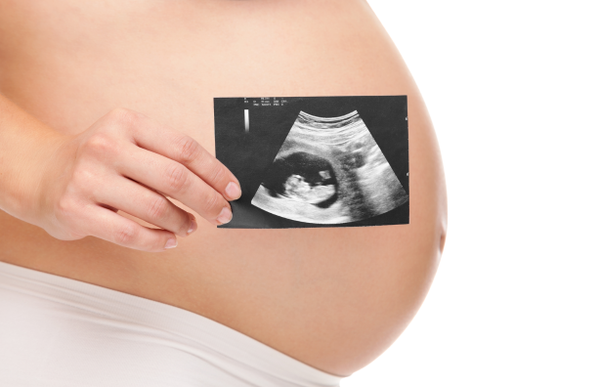 Rạn da thường xuất hiện vào tháng thứ 6 - 7 của thai kỳ| Special Mum