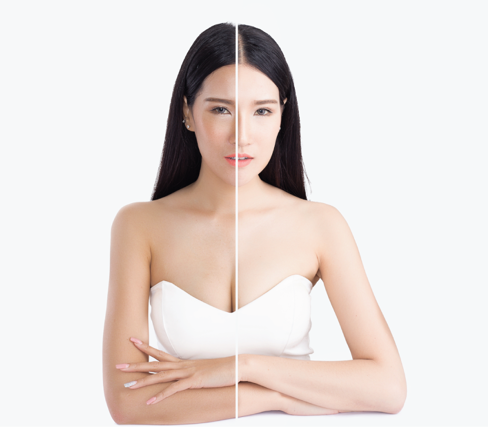 Why do Asian women like white skin?