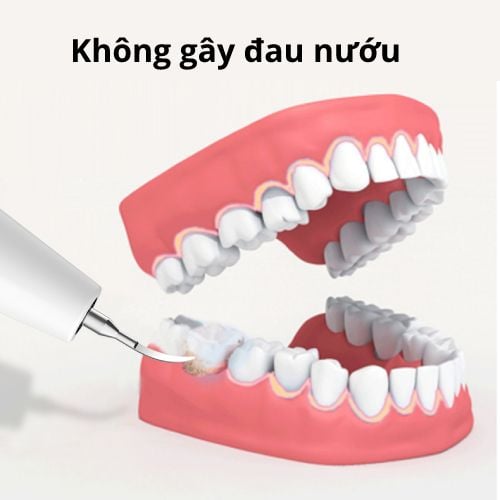 Bút tẩy trắng răng nha khoa bằng Sóng siêu âm 3D Chuẩn FDA USA - SUPER WHITE