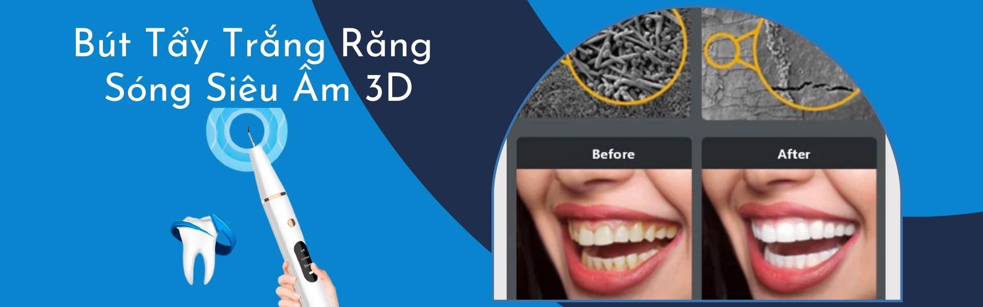 Chăm sóc răng bằng Bút tẩy trắng răng nha khoa bằng sóng siêu âm 3D - Super White