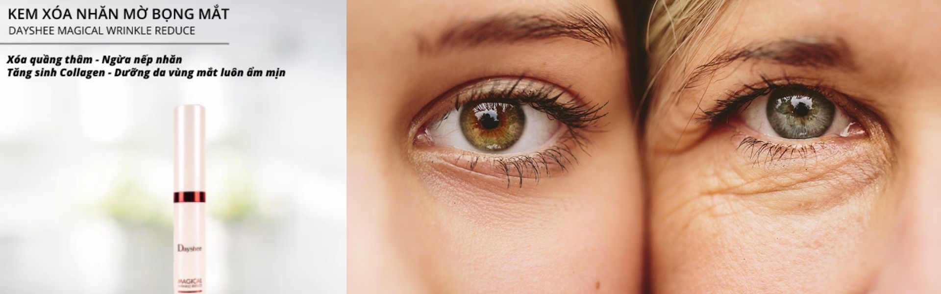 Tìm hiểu về kem trị xóa nếp nhăn quanh mắt