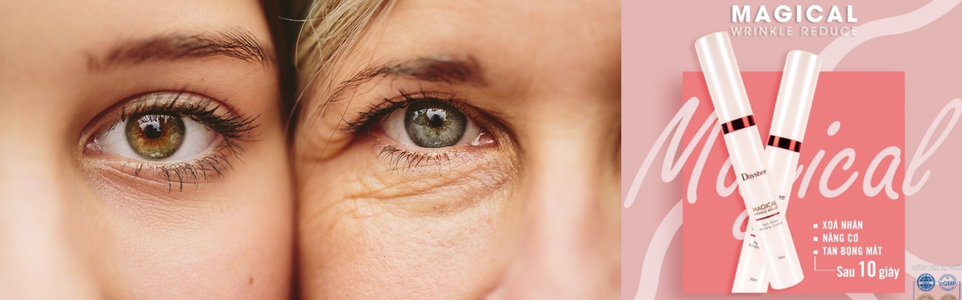 Kem xóa nhăn vùng mắt chống lão hóa cấp tốc hiệu quả