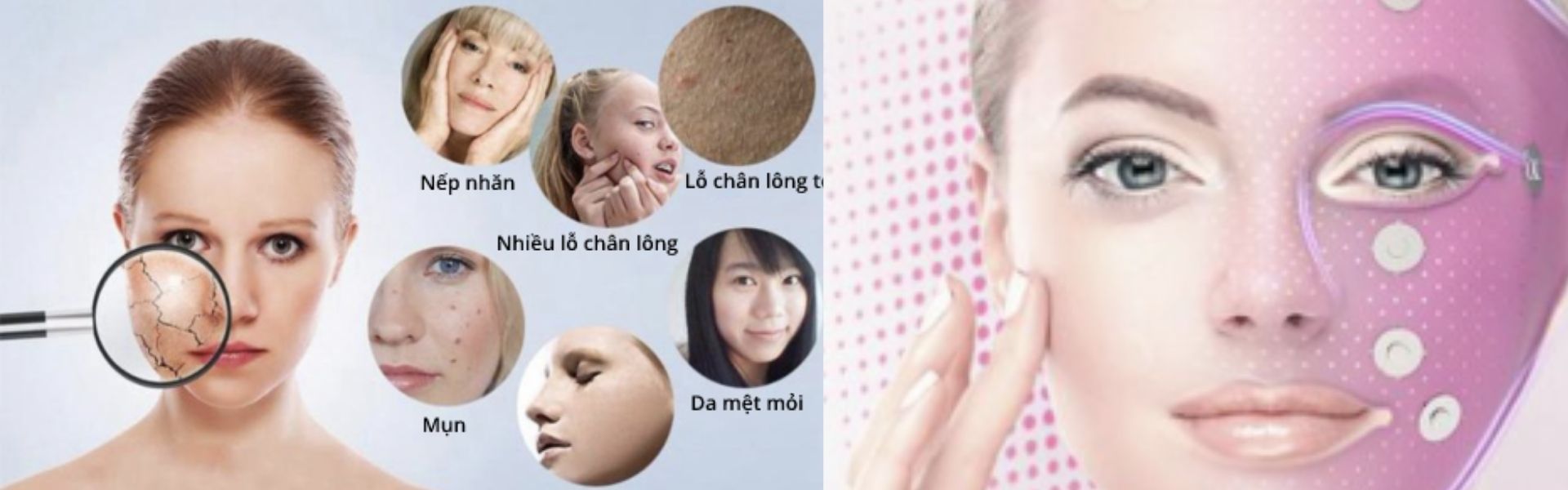 Sửa chữa lỗi mặt nạ nâng cơ 3D massage 360 độ trị mụn công nghệ EMS