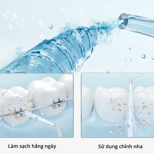Máy tăm nước nha khoa vệ sinh răng miệng cầm tay chất liệu ABS Cao Cấp - MASTER CLEAN