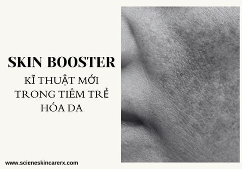 SKIN BOOSTER - KỸ THUẬT MỚI TRONG TIÊM TRẺ HÓA DA HIỂU SAO CHO ĐÚNG