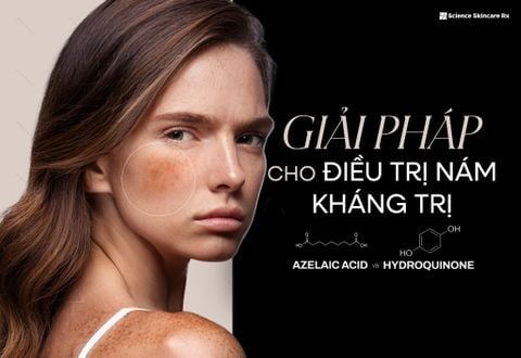 Giải Pháp MỚI Cho Nám Kháng Trị: Laser Kết Hợp Azelaic Acid