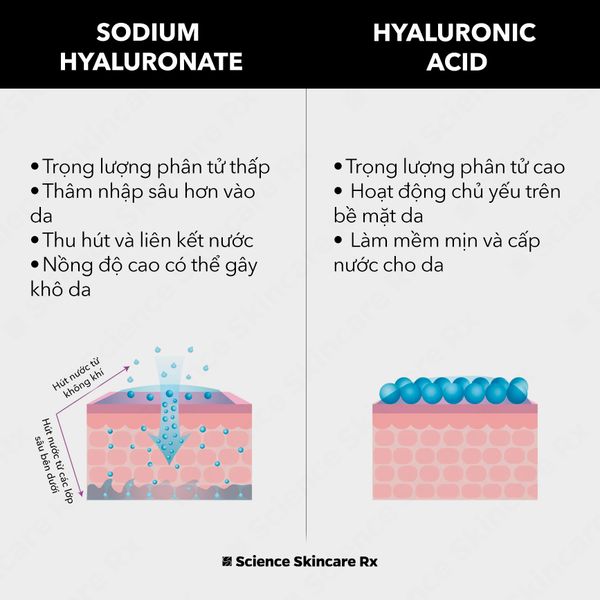 Bo-doi-cap-am-sau-peel