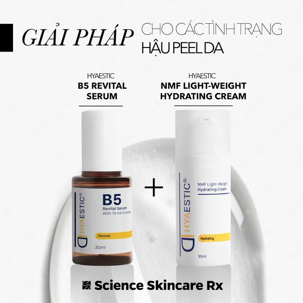 Bo-doi-cap-am-sau-peel