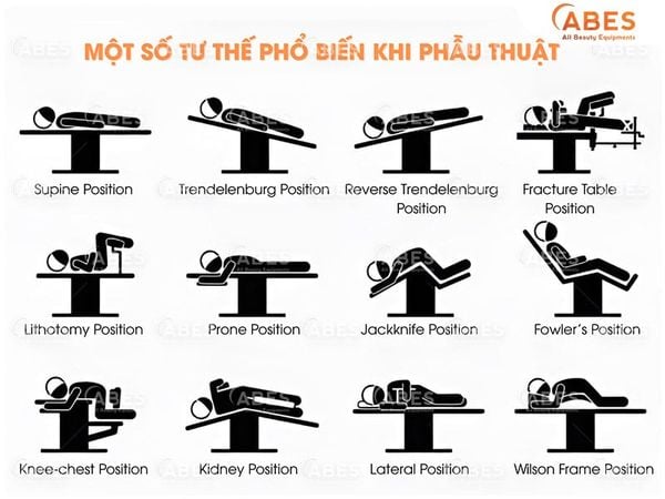 Bàn Mổ Là Gì? Cấu Tạo, Chức Năng Và Phân Loại Phổ Biến