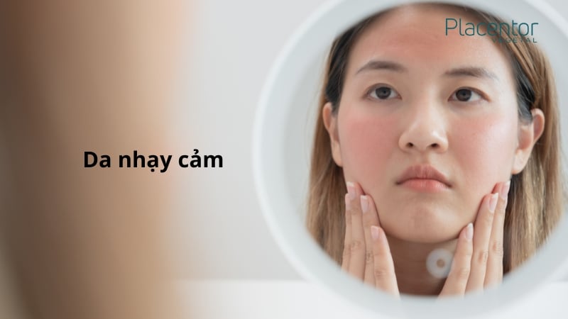 Hướng dẫn chọn sữa rửa mặt cho da nhạy cảm