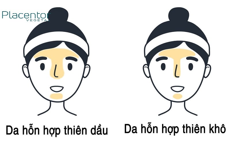 Da hỗn hợp là da như thế nào?