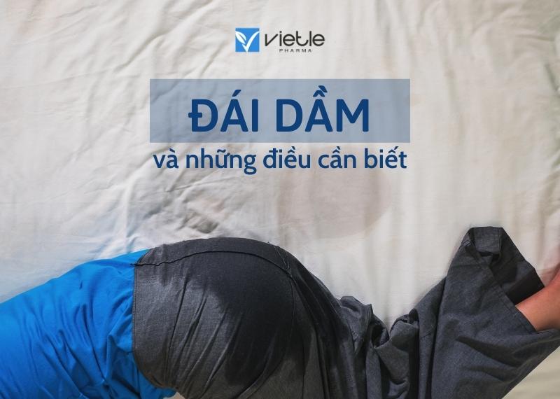 ĐÁI DẦM và những điều cần biết