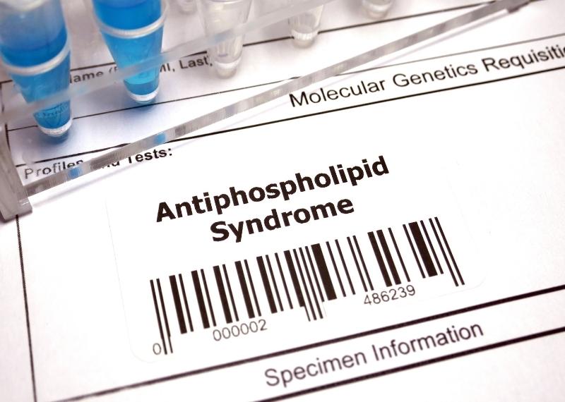 HỘI CHỨNG KHÁNG PHOSPHOLIPID LÀ GÌ? TRIỆU CHỨNG VÀ ĐIỀU TRỊ