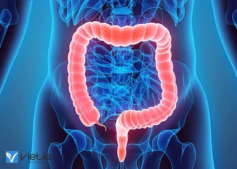 HỘI CHỨNG RUỘT KÍCH THÍCH: TRIỆU CHỨNG VÀ CÁCH ĐIỀU TRỊ