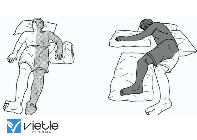 Liệt nửa người và những thông tin cần thiết để chăm sóc bệnh nhân