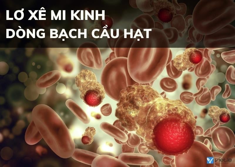LƠ XÊ MI KINH DÒNG BẠCH CẦU HẠT - BỆNH MÁU ÁC TÍNH