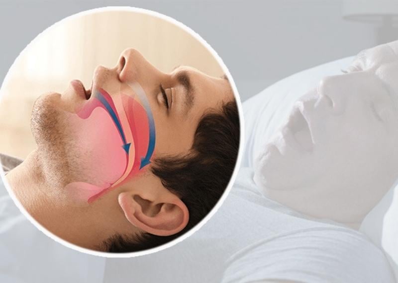 NGƯNG THỞ KHI NGỦ: NHỮNG ĐIỀU CẦN BIẾT