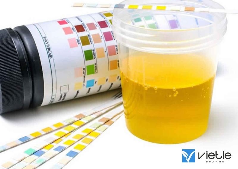 TIẾP CẬN CHẨN ĐOÁN PROTEIN NIỆU TRONG NHI KHOA