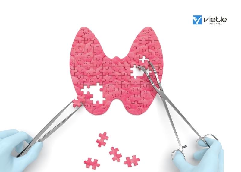 Suy tuyến giáp bẩm sinh tiên phát