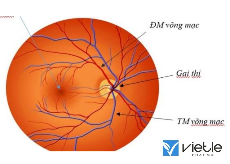 Tắc động mạch võng mạc trung tâm là gì?