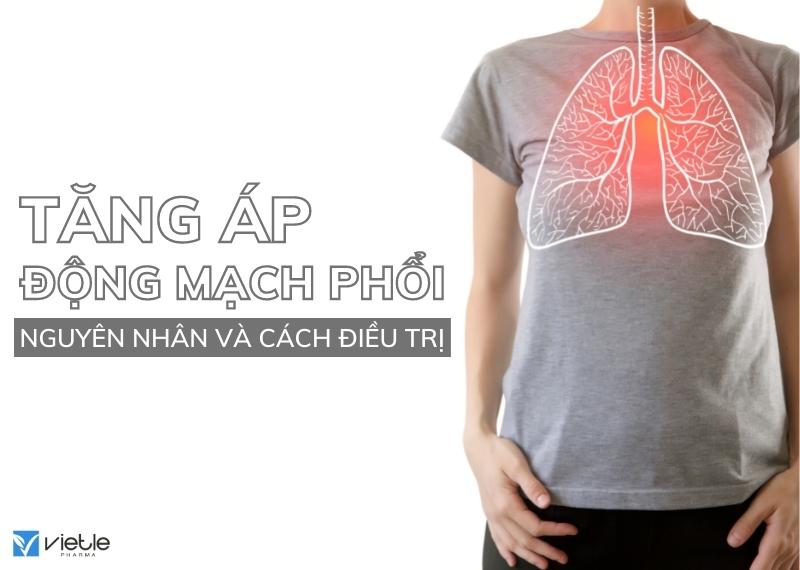 TĂNG ÁP ĐỘNG MẠCH PHỔI - NGUYÊN NHÂN VÀ CÁCH ĐIỀU TRỊ