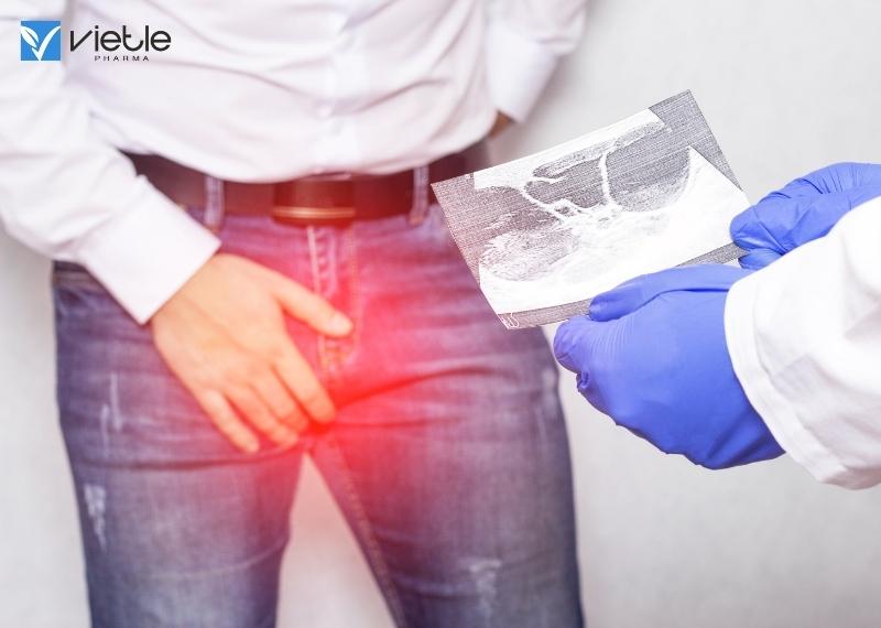 Tràn dịch tinh mạc và những điều cần biết