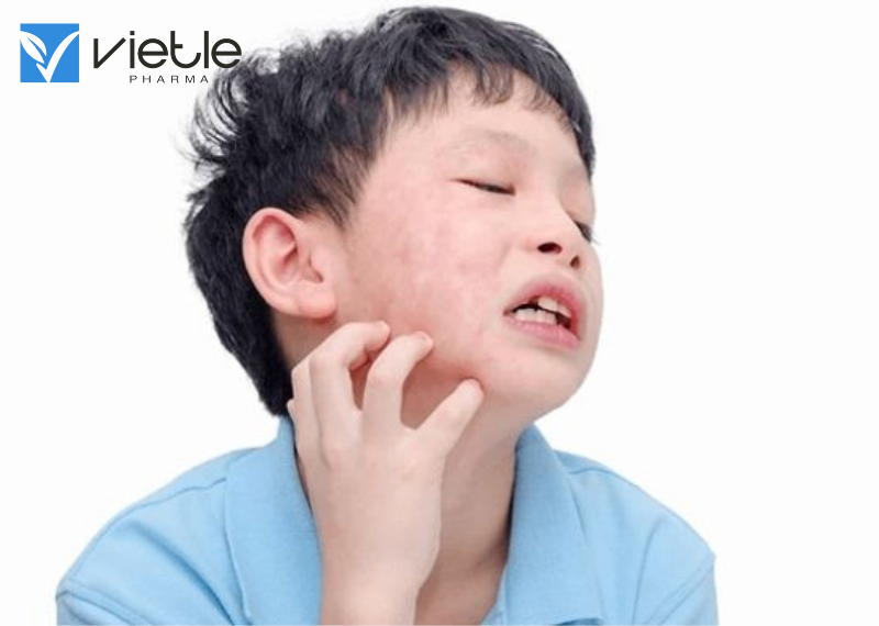 QUAI BỊ VÀ NHỮNG ĐIỀU CẦN BIẾT