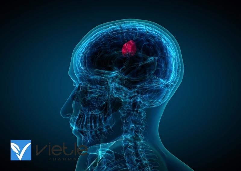 U NÃO: NGUYÊN NHÂN, CHẨN ĐOÁN VÀ ĐIỀU TRỊ