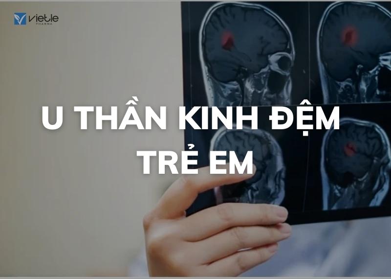 U THẦN KINH ĐỆM TRẺ EM - CHẨN ĐOÁN VÀ ĐIỀU TRỊ