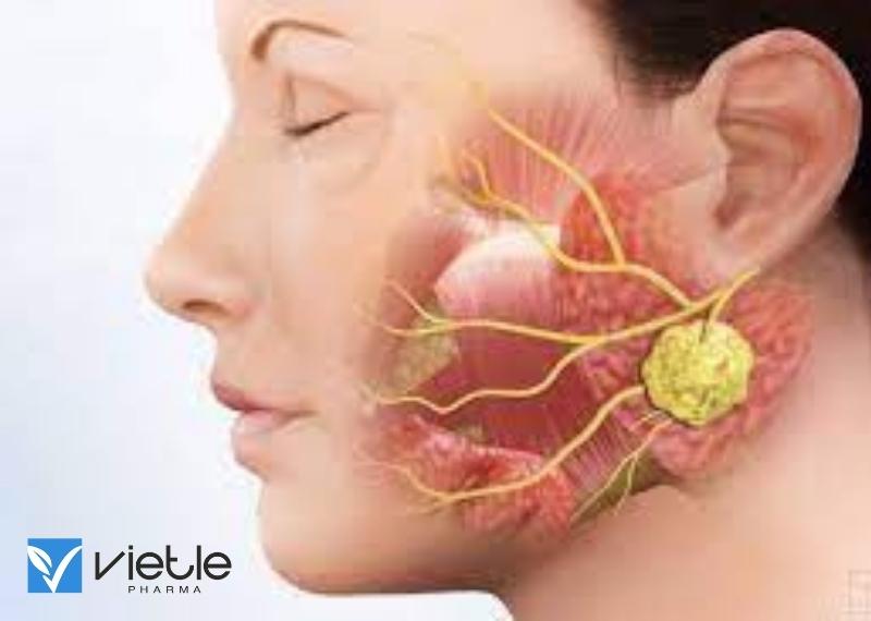 UNG THƯ TUYẾN NƯỚC BỌT VÀ NHỮNG ĐIỀU CẦN BIẾT