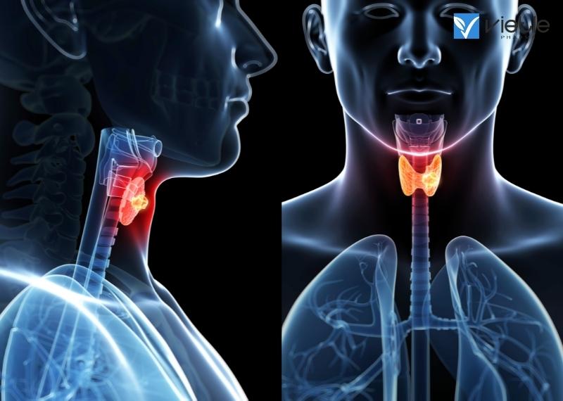 Mối nguy hiểm từ ung thư vòm mũi họng và những điều cần lưu ý