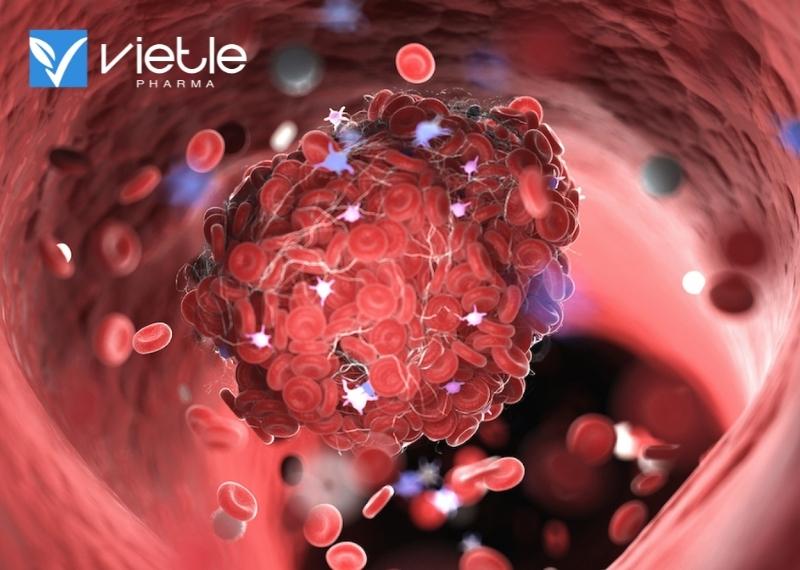 VACCINE COVID-19 VÀ CỤC MÁU ĐÔNG