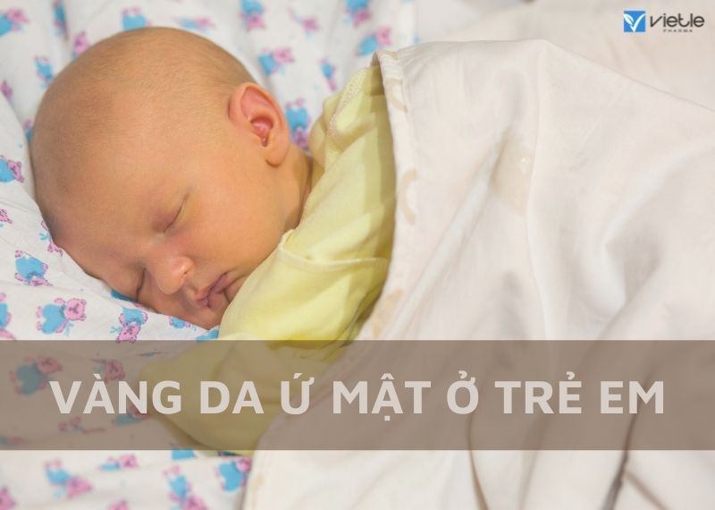 Vàng da ứ mật ở trẻ em: các nguyên nhân thường gặp