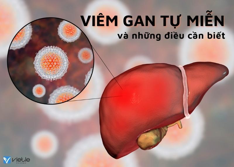 VIÊM GAN TỰ MIỄN - NHỮNG ĐIỀU CẦN BIẾT