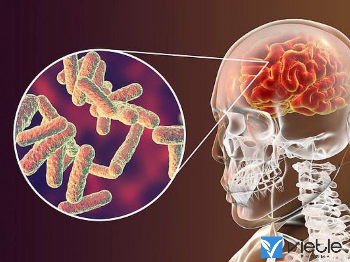 VIÊM MÀNG NÃO NHIỄM KHUẨN VÀ NHỮNG ĐIỀU CẦN BIẾT