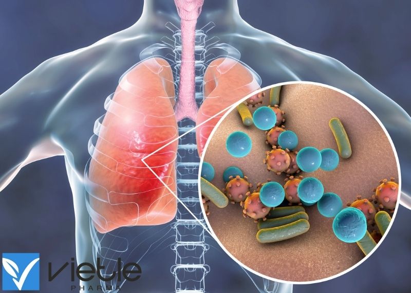 Viêm phổi do vi khuẩn ở trẻ em nhận biết như thế nào?