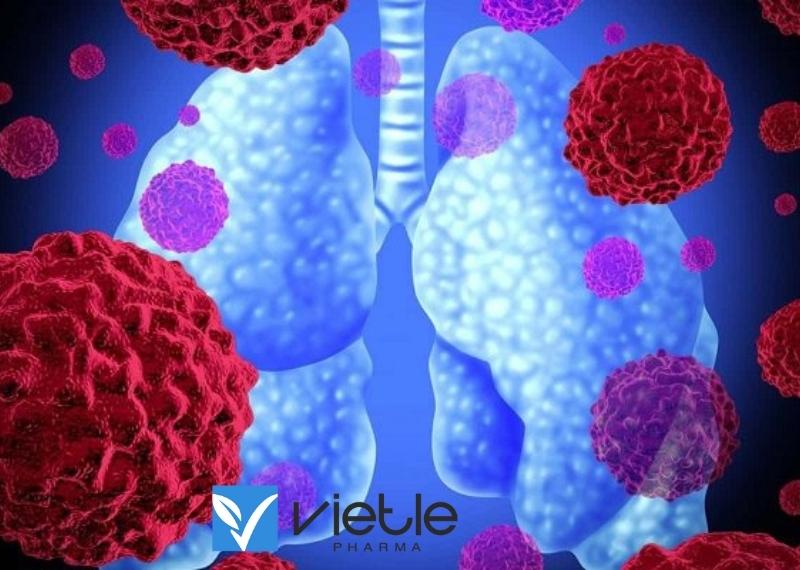 VIÊM PHỔI MẮC PHẢI Ở BỆNH VIỆN VÀ NHỮNG ĐIỀU CẦN BIẾT