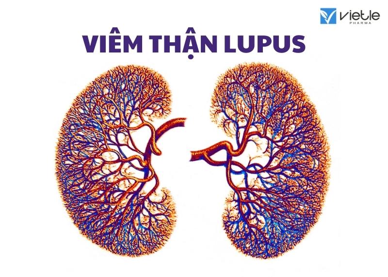 Viêm thận Lupus có nguy hiểm không?