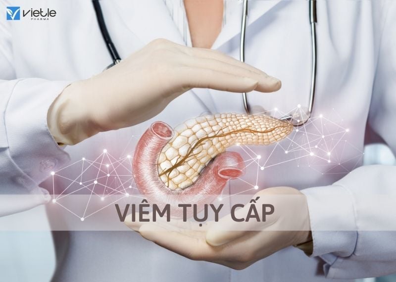 VIÊM TỤY CẤP: chẩn đoán và điều trị
