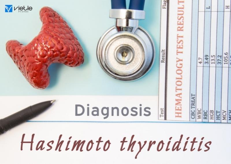Viêm tuyến giáp Hashimoto là bệnh gì ?