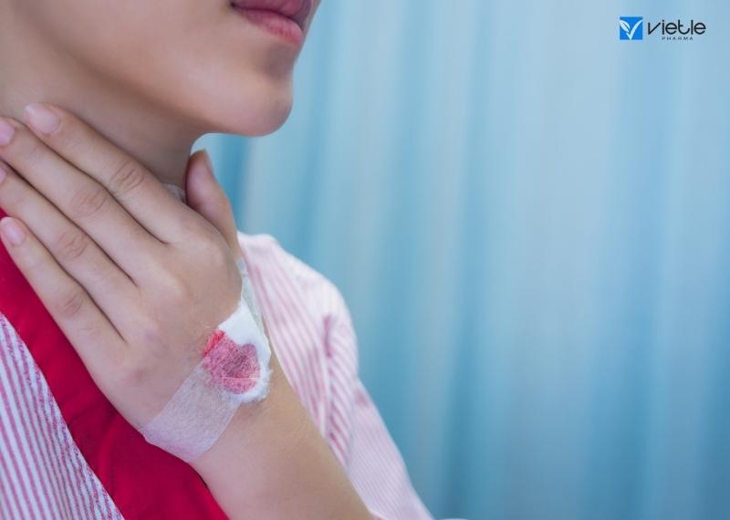 Viêm tuyến giáp mủ: Nguyên nhân và cách điều trị