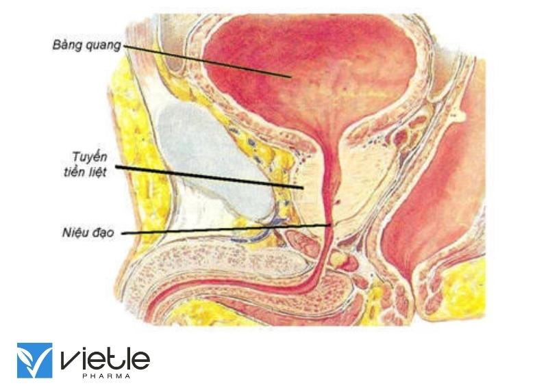 Viêm tuyến tiền liệt cấp: Triệu chứng và điều trị